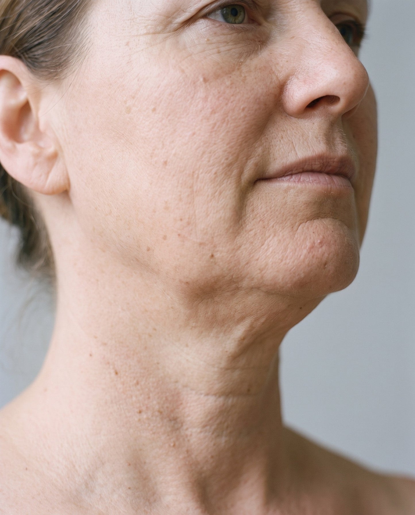 PhotoMed Contour Pro - 13 jawline profile