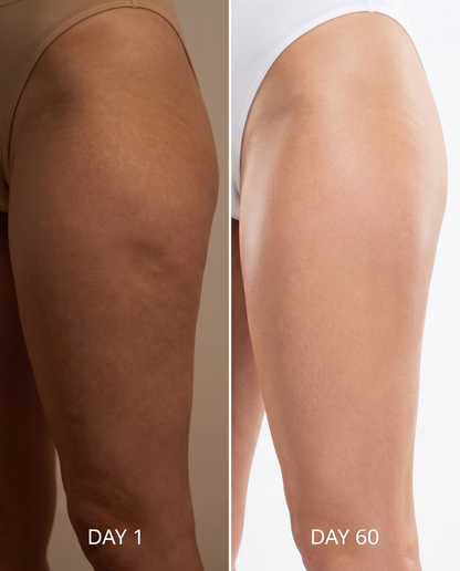 PhotoMed BandV2 — Day 1 vs Day 60 firmness comparison